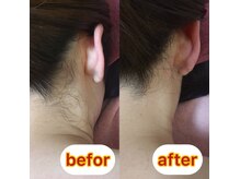 ユウ 川越店(yu)の雰囲気（安心都度払いで、お肌が綺麗になる光脱毛でつるすべ肌に！）