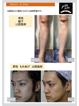 ジョリージョリー(jolie jolie)/参考資料3