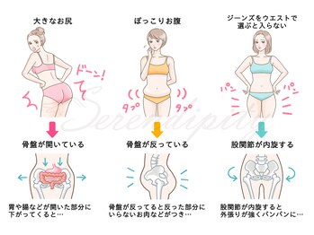 セレンディピティ 守山店(Serendipity)/女性の為に本気で作った骨盤矯正