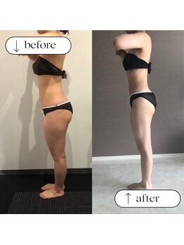 トータルビューティーサロンリア(Li'a)/ビフォー＆アフター