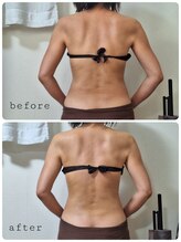 ナチュラ(Natura)/バザルトバストケア！