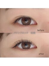 プロッソル こころ(PROSOL)/バインドロック６０束