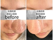 オーガニックラボ(オーガニックLab)の雰囲気（お困りお肌へ根気強く向き合いましょう！）