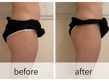 スパジュエル(SPA JEWEL)/