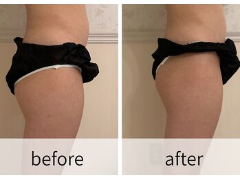 スパジュエル(SPA JEWEL)/