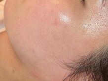 コモレビ(komorebi)