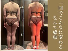 ザ モアナテラス(THE MOANA TERRACE)/施術１回の変化