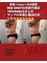 美温(mion)/インディバ×レッドショット