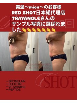 美温(mion)/インディバ×レッドショット