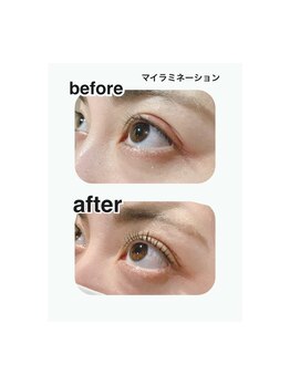 ファーストアイ(First eye)/＃マイラミネーション