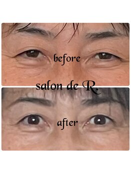 サロン ド アール(salon de R.)/【小顔骨氣・50代・お目元効果】