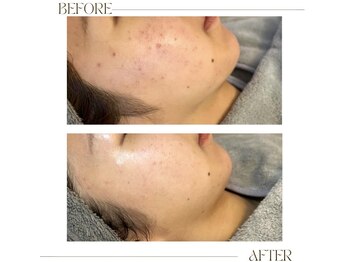 アンド(&.)/before/after