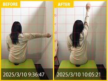 整体院 元 宇城松橋店/右肩挙上時の悩み