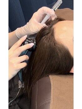 エスカペリ(s_capelli)/育毛促進剤導入