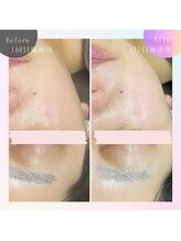 ビューティサロン ベルティア(Beltia)/#ダイエット#痩身#ブライダル