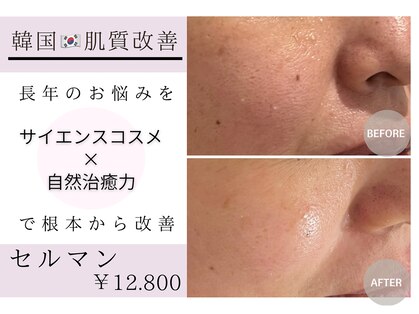 アンベリール(embellir.)の写真