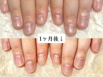 グラシナ なんば店/深爪/自爪育成/フィルイン