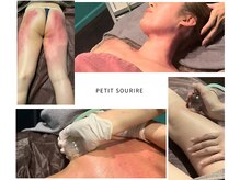 プティットスリール エステティック 栄本店(Petit Sourire Esthetic)の雰囲気（SNSで話題！セル撃退マシン(スライドカッピング)）