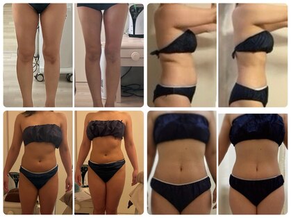 ナースのロミリンパの写真