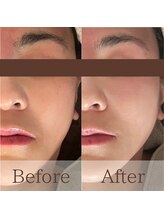 凪眠/小顔リンパフェイシャルの効果37