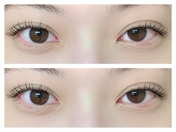 ローランリム(LORAN Lim)/フラットラッシュ100本