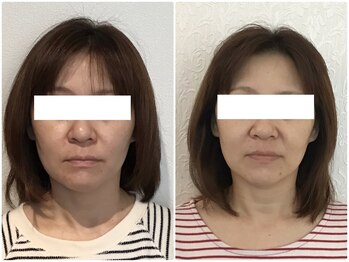 ウェリナ平和堂長久手院/小顔矯正/骨盤矯正/痩身/整体