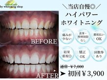 ホワイトニングショップ(whitening shop)