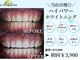 ホワイトニングショップ(whitening shop)の写真