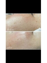 コンディションスキン(condition skin)/