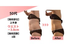 クレビア(Clevia)/Clevia-クレビア