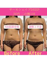 リラクゼーションサロン ラキ(laki)/サーモシェイプ&NR筋膜骨格調整