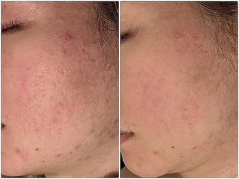 レスイズモア 恵比寿(less is more.)/一度の[はちみつパック付]