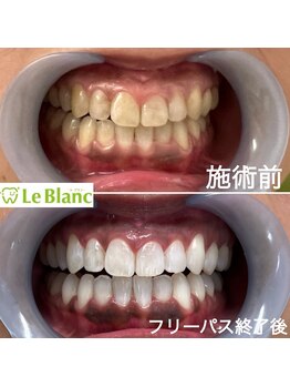 ルブラン 奈良店(Le Blanc)/健康な歯に！