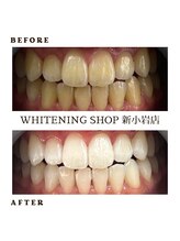 ホワイトニングショップ 新小岩店/歯科提携　ホワイトニング専門店