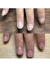 リリ(lili)/ハンドトータルケア/ネイルケア