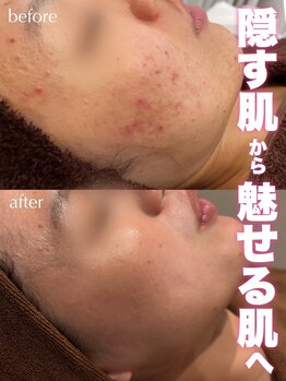 ジェノール 飾磨本店(JNOEL)/隠す肌から魅せる肌へ！