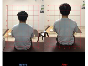 ストレチックス 近江八幡店/姿勢改善ビフォーアフター1回