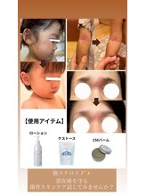 コンディションスキン(condition skin)/