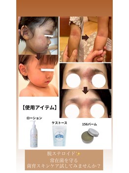 コンディションスキン(condition skin)/