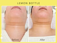 シロカネ イオンタウン西熊本店(SHIROKANE)/レモンボトル☆