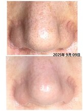 ミント/お肌の弱い方でも大丈夫