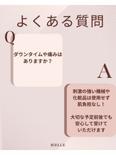 ビエル(Bielle)&nbsp;痛み怖い人 でも大丈夫