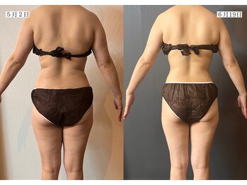 サロンドカメリア(salon de Camellia)/『健康な体重になる』のが目的