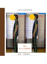 あらかき接骨院/【姿勢の変化】