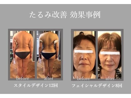 ナルエステティック(NARU.esthetic)の写真
