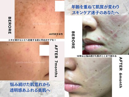 エステティックス ナインワンワン 横浜(Esthetics911) の写真