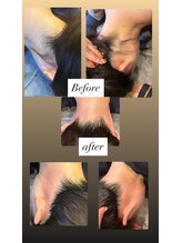 コンディションスキン(condition skin)/