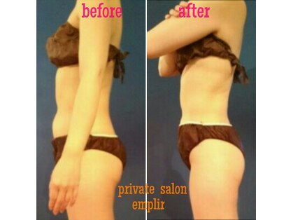 アンプリール(emplir)の写真