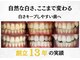 LBSホワイトニング 新宿店の写真