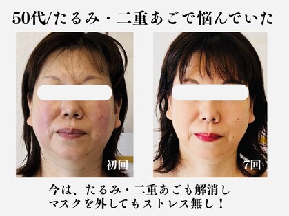 ランティル(l’until)の写真